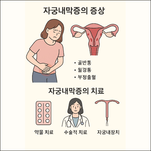 자궁내막증