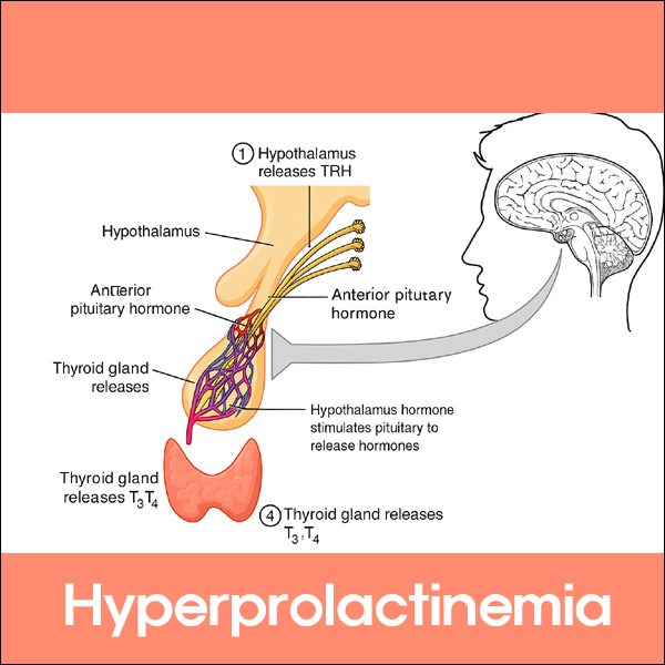 고프로락틴혈증